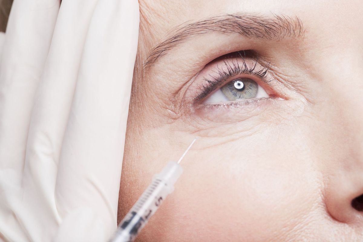 close-up van vrouw die botox-injectie onder oog ontvangt